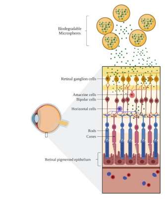 Un nuevo sistema de liberación de fármacos para un tratamiento integral del glaucoma.